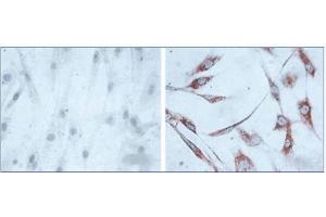Immunohistochemistry of human skin fibroblasts (Left: control, Right: 24 hours after 7th passage of senescence). (HSPD1 anticorps)