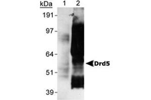 Detection of Drd5 of Sf9 cells transfected with rat Drd5 using Drd5 monoclonal antibody, clone SG4-D1b . (DRD5 anticorps  (C-Term))