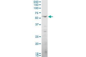 PNKP polyclonal antibody (A01), Lot # 051017JC01.