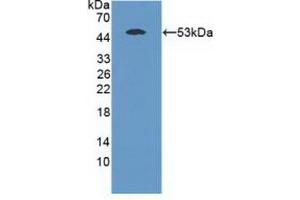 Detection of Recombinant MASP1, Mouse using Polyclonal Antibody to Mannose Associated Serine Protease 1 (MASP1) (MASP1 anticorps  (AA 25-453))
