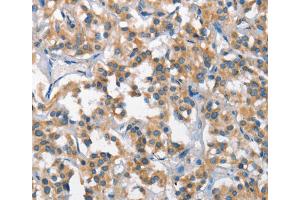 Immunohistochemistry (IHC) image for anti-Scavenger Receptor Class B, Member 1 (SCARB1) antibody (ABIN2428211) (SCARB1 anticorps)