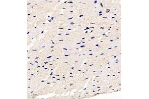 Immunohistochemistry of paraffin embedded rat heart using Hes2 (ABIN7074158) at dilution of 1:200 (400x lens)