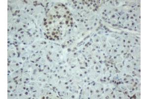 Image no. 2 for anti-Chromobox Homolog 8 (CBX8) (AA 1-260) antibody (ABIN1490663)