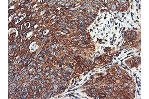 Image no. 6 for anti-phosphofructokinase, Platelet (PFKP) antibody (ABIN1500164)