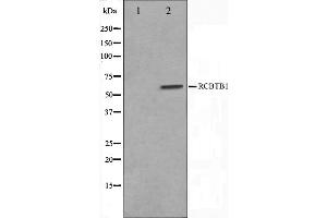 Western blot analysis on LOVO cell lysate using RCBTB1 Antibody,The lane on the left is treated with the antigen-specific peptide. (RCBTB1 anticorps  (Internal Region))