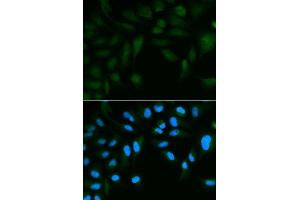 Immunofluorescence analysis of HepG2 cell using EPPIN antibody. (Eppin anticorps)