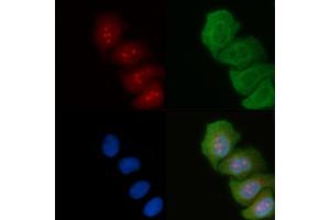 ABIN6264187 and ABIN6274036 staining Hela cells(45 min of heat-shock) by IF/ICC. (PIK3R2 anticorps  (C-Term))