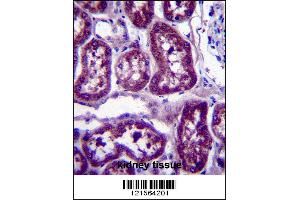 DPYS Antibody immunohistochemistry analysis in formalin fixed and paraffin embedded human kidney tissue followed by peroxidase conjugation of the secondary antibody and DAB staining. (DPYS anticorps  (C-Term))