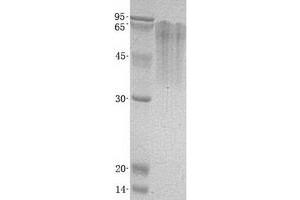 Validation with Western Blot