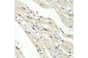 Immunohistochemistry of paraffin-embedded mouse heart using UPF1 antibody at dilution of 1:100 (x40 lens). (RENT1/UPF1 anticorps)