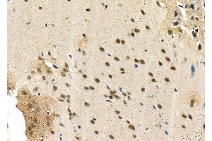 ABIN6263139 and ABIN6266820 at 1/100 staining Rat brain tissue by IHC-P. (MAST3 anticorps  (Internal Region))