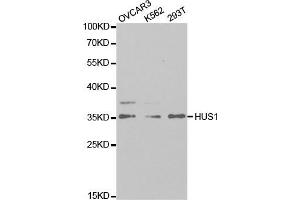 Western Blotting (WB) image for anti-HUS1 Checkpoint Homolog (S. Pombe) (HUS1) antibody (ABIN1876595) (HUS1 anticorps)