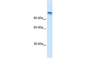 WB Suggested Anti-TIP120A Antibody Titration:  1.