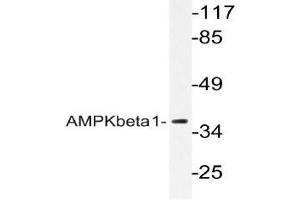 Western blot (WB) analyzes of AMPKbeta1 antibody in extracts from Jurkat cells. (PRKAB1 anticorps)