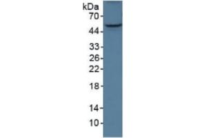 Rabbit Detection antibody from the kit in WB with Positive Control:  Sample Mouse placenta lysate.