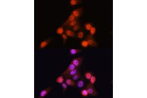 Immunofluorescence analysis of HeLa cells using CDKN2A/p16INK4a Rabbit mAb (ABIN6131541, ABIN6139280, ABIN6139282 and ABIN7101380) at dilution of 1:100 (40x lens).