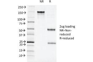 SDS-PAGE Analysis Purified CD11c Mouse Monoclonal Antibody (ITGAX/1243).