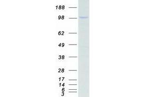 Validation with Western Blot