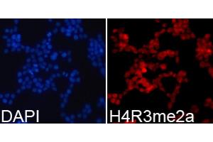 Immunofluorescence analysis of 293T cells using Asymmetric DiMethyl-Histone H4-R3 antibody (ABIN3016059, ABIN3016060, ABIN3016061, ABIN1680261 and ABIN6219537). (Histone H4 anticorps  (2meArg3))