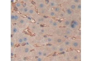 DAB staining on fromalin fixed paraffin- embedded Kidney tissue)