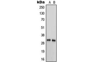 Western blot analysis of Trypsin 3 expression in MDAMB231 (A), HL60 (B) whole cell lysates. (PRSS3 anticorps  (Center))