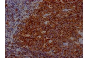 IHC image of ABIN7127396 diluted at 1:100 and staining in paraffin-embedded human tonsil tissue performed on a Leica BondTM system.
