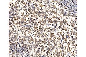 IHC analysis of RPL8 using anti-RPL8 antibody (ABIN7601179).