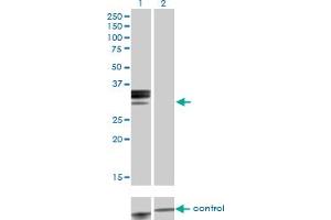 Western blot analysis of HPX over-expressed 293 cell line, cotransfected with HPX Validated Chimera RNAi (Lane 2) or non-transfected control (Lane 1). (Hemopexin anticorps  (AA 1-254))