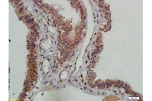 Formalin-fixed and paraffin embedded human ovarian tissue labeled with Anti-DNAPK/PRKDC Polyclonal Antibody, Unconjugated (ABIN685417) followed by conjugation to the secondary antibody and DAB staining