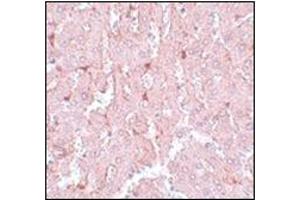 Immunohistochemistry of LXR-A in rat liver tissue with this product at 5 μg/ml. (NR1H3 anticorps  (N-Term))
