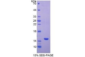 SDS-PAGE of Protein Standard from the Kit (Highly purified E. (GFAP Kit ELISA)