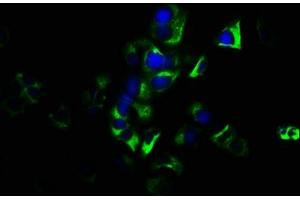 Immunofluorescence staining of MCF-7 cells with ABIN7154680 at 1:133, counter-stained with DAPI. (GNG7 anticorps  (AA 2-65))