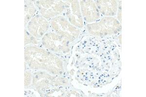 Immunohistochemistry of paraffin-embedded Human kidney (negative control sample) using CD79a antibody (ABIN7265805) at dilution of 1:100 (40x lens).