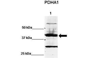 WB Suggested Anti-PDHA1 Antibody    Positive Control:  Lane 1: 60ug human NT2 cell line   Primary Antibody Dilution :   1:500  Secondary Antibody :  IRDye 800 CW goat anti-rabbit from Li-COR Bioscience  Secondry Antibody Dilution :   1:20,000  Submitted by:  Dr. (PDHA1 anticorps  (C-Term))