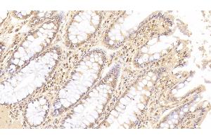 Detection of ANGPT1 in Human Colon Tissue using Monoclonal Antibody to Angiopoietin 1 (ANGPT1)