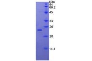 SDS-PAGE of Protein Standard from the Kit (Highly purified E. (BMP4 Kit ELISA)