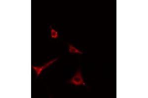 ABIN6269299 staining Hela cells by IF/ICC. (ADAM17 anticorps  (C-Term))