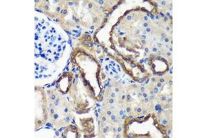 Immunohistochemistry of paraffin-embedded Rat kidney using C18orf8 Rabbit pAb (ABIN7266379) at dilution of 1:100 (40x lens). (C18orf8 anticorps  (AA 1-300))