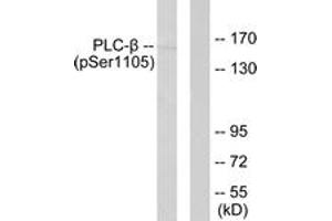 Western blot analysis of extracts from A431 cells, using PLCB3 (Phospho-Ser1105) Antibody. (PLCB3 anticorps  (pSer1105))