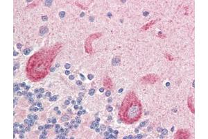 Human Brain, Cerebellum (formalin-fixed, paraffin-embedded) stained with LGI4at 5 µg/ml followed by biotinylated goat anti-rabbit IgG secondary antibody, alkaline phosphatase-streptavidin and chromogen. (LGI4 anticorps)