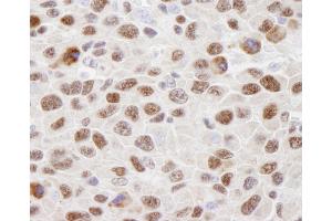 Immunohistochemistry (IHC) image for anti-Heterogeneous Nuclear Ribonucleoprotein U (Scaffold Attachment Factor A) (HNRNPU) (AA 450-500) antibody (ABIN7448599)