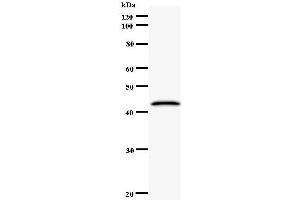 Western Blotting (WB) image for anti-CCR4-NOT Transcription Complex, Subunit 6 (CNOT6) antibody (ABIN932464) (CNOT6 anticorps)
