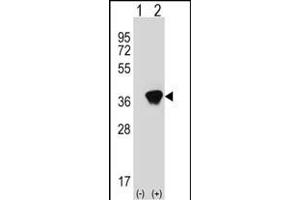 Western blot analysis of AKR1A1 (arrow) using rabbit polyclonal AKR1A1 Antibody (C-term) (ABIN389204 and ABIN2837921).