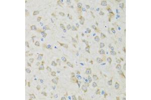 Immunohistochemistry of paraffin-embedded mouse brain using CLCN7 antibody (ABIN2561888) at dilution of 1:100 (40x lens).