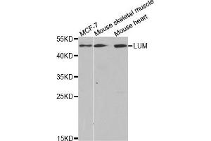 Western Blotting (WB) image for anti-Lumican (LUM) antibody (ABIN1876540) (LUM anticorps)