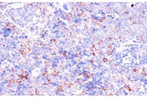 Immunohistochemistry of paraffin-embedded Mouse spleen using CD18 Polyclonal Antibody at dilution of 1:100 (40x lens). (Integrin beta 2 anticorps)