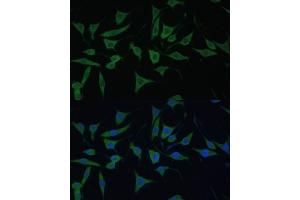 Immunofluorescence analysis of L929 cells using HIBCH antibody (ABIN7265331) at dilution of 1:100.