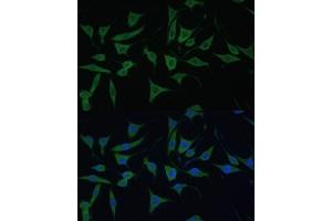 Immunofluorescence analysis of L929 cells using HIBCH antibody (ABIN7265331) at dilution of 1:100. (HIBCH anticorps  (AA 33-330))