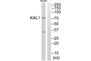 Western Blotting (WB) image for anti-Kallmann Syndrome 1 Sequence (KAL1) (Internal Region) antibody (ABIN1850776) (KAL1 anticorps  (Internal Region))