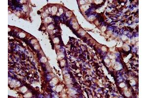 anti-Cerebellar Degeneration-Related Protein 2-Like (CDR2L) (AA 376-465) antibody